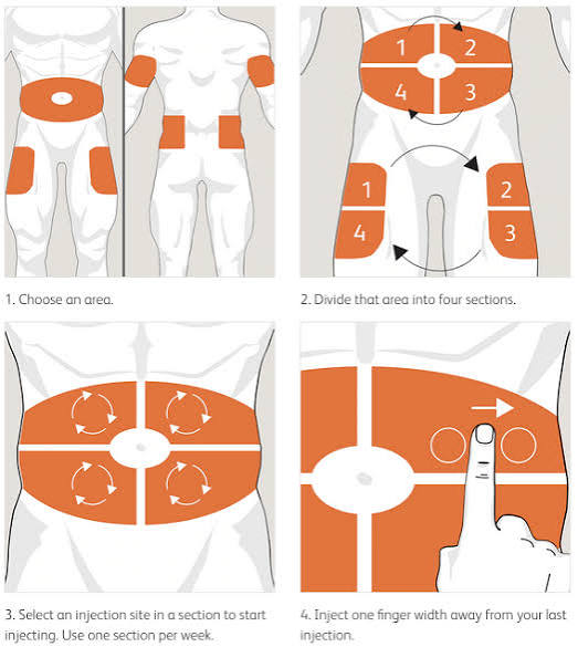 Why Rotating Your Injection Sites Actually Matters — diabetes education