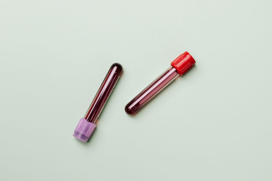 When HbA1c Can Be Wrong, and Why It Sometimes Lies to You — diabetes education
